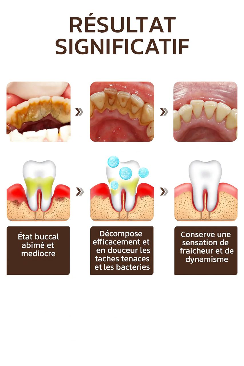 Dentifrice Éclat Suprême – Dents plus blanches, haleine fraîche et gencives renforcées