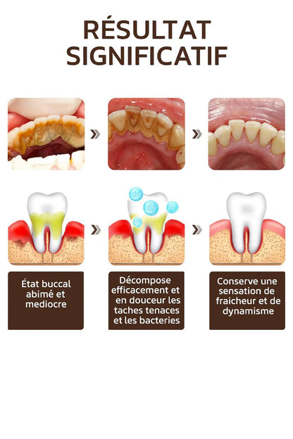 Dentifrice Éclat Suprême – Dents plus blanches, haleine fraîche et gencives renforcées